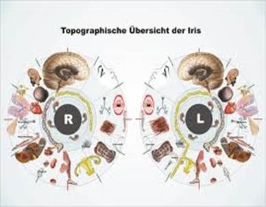 Iris